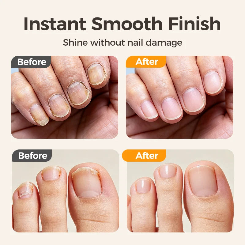 💅 2-in-1 Electric Nail Clipper & Smoother 🌟